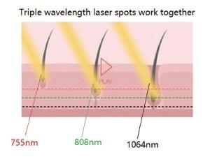  Диодный лазер для удаления волос FG2000-B 